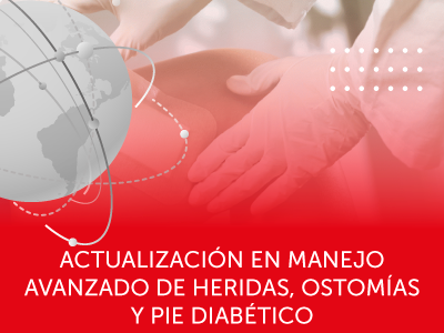 ACTUALIZACIÓN EN MANEJO AVANZADO DE HERIDAS, OSTOMÍAS Y PIE DIABÉTICO.   HOSPITAL SAN CARLOS.